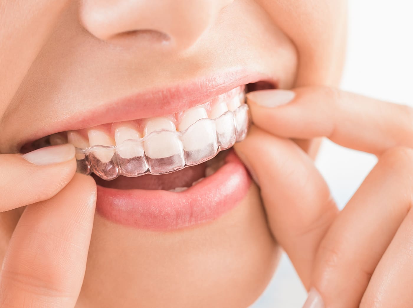 Beautiful smile and white teeth of a young woman.