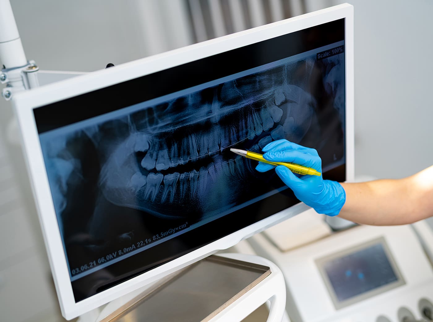 dental xrays on screen in dental office in london ontario