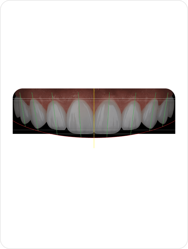 Teeth Smile Design Software