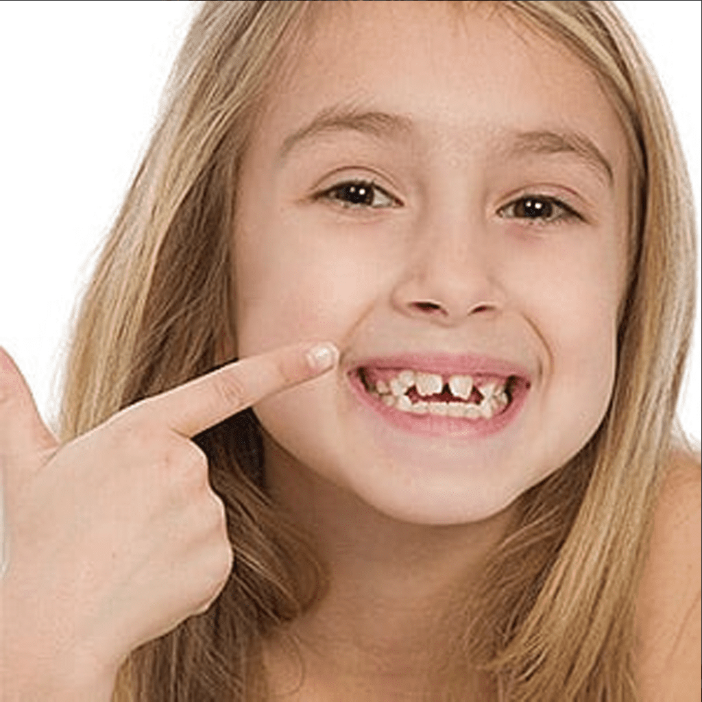 6 Signs Your Child Could Be Developing A Poor Bite