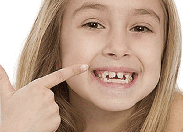 6 Signs Your Child Could Be Developing A Poor Bite