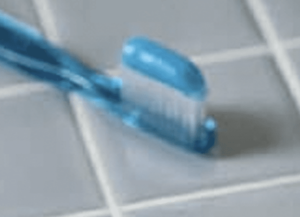 Bad Breath (halitosis)