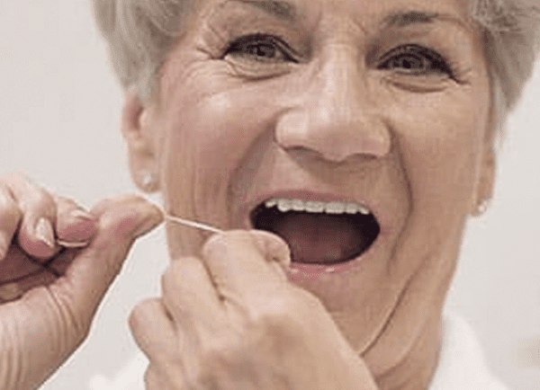 Keep The Space Between An Implant-Supported Bridge And The Gums Clean - thumb