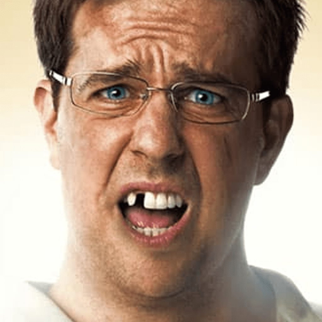 The Real Truth Behind Ed Helms’ Missing Tooth In “The Hangover”