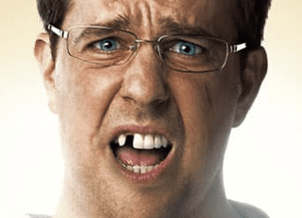 The Real Truth Behind Ed Helms’ Missing Tooth In “The Hangover”