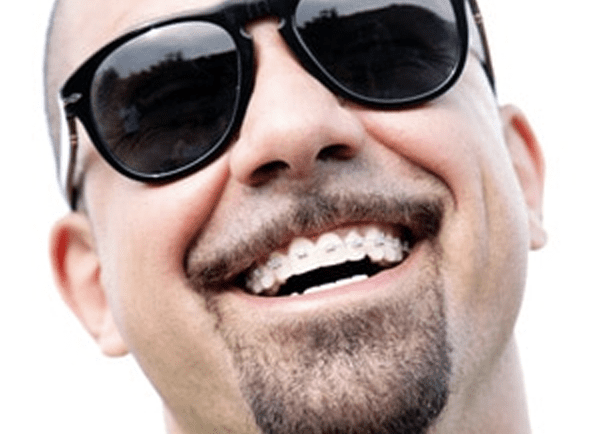 You May Need Orthodontic Work Before Getting A Dental Implant